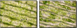 10_elodea, normal and plasmolyzed