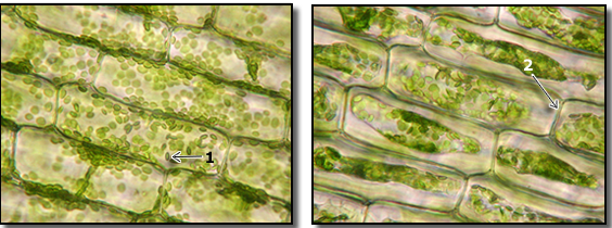 Described under the heading 7. Plant Cells and Osmosis.