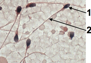 05a_sperm (cropped)