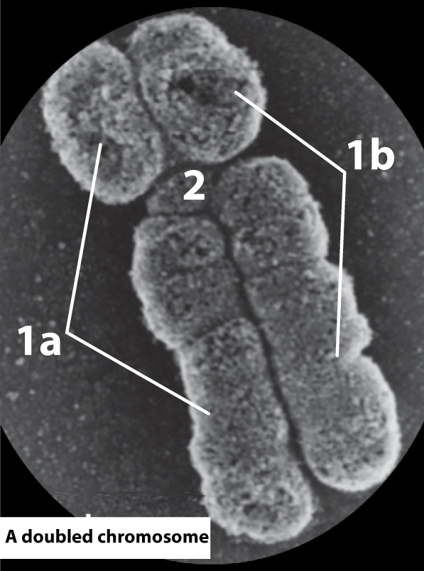 Photomicrograph of a doubled chromosome.