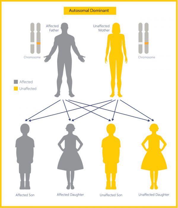 An affected father and an unaffected mother mate producing the following potential outcomes: affected son, affected daughter, unaffected son, and unaffected daughter.