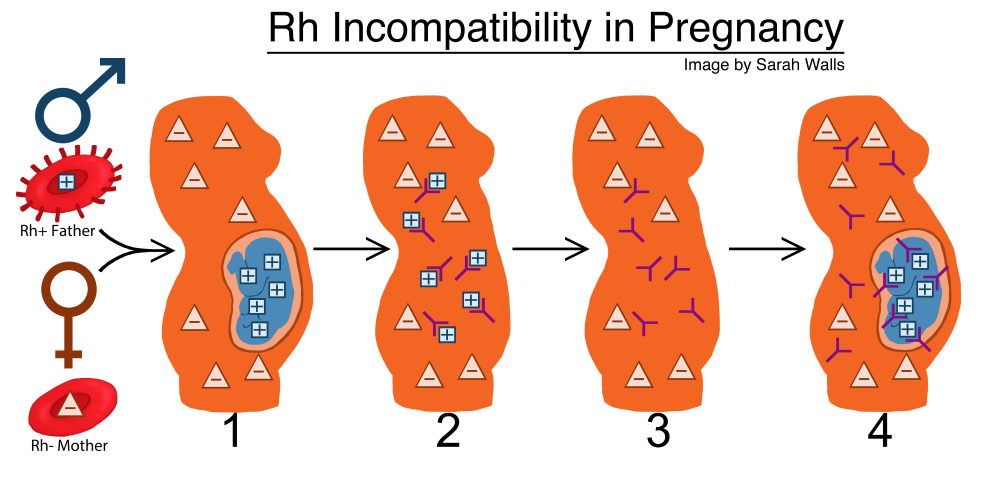 Described under the heading 4. What about blood types like A+, or O-?