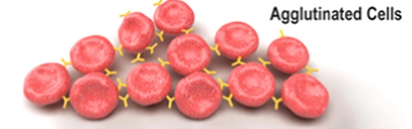Agglutinated cells clumping together.