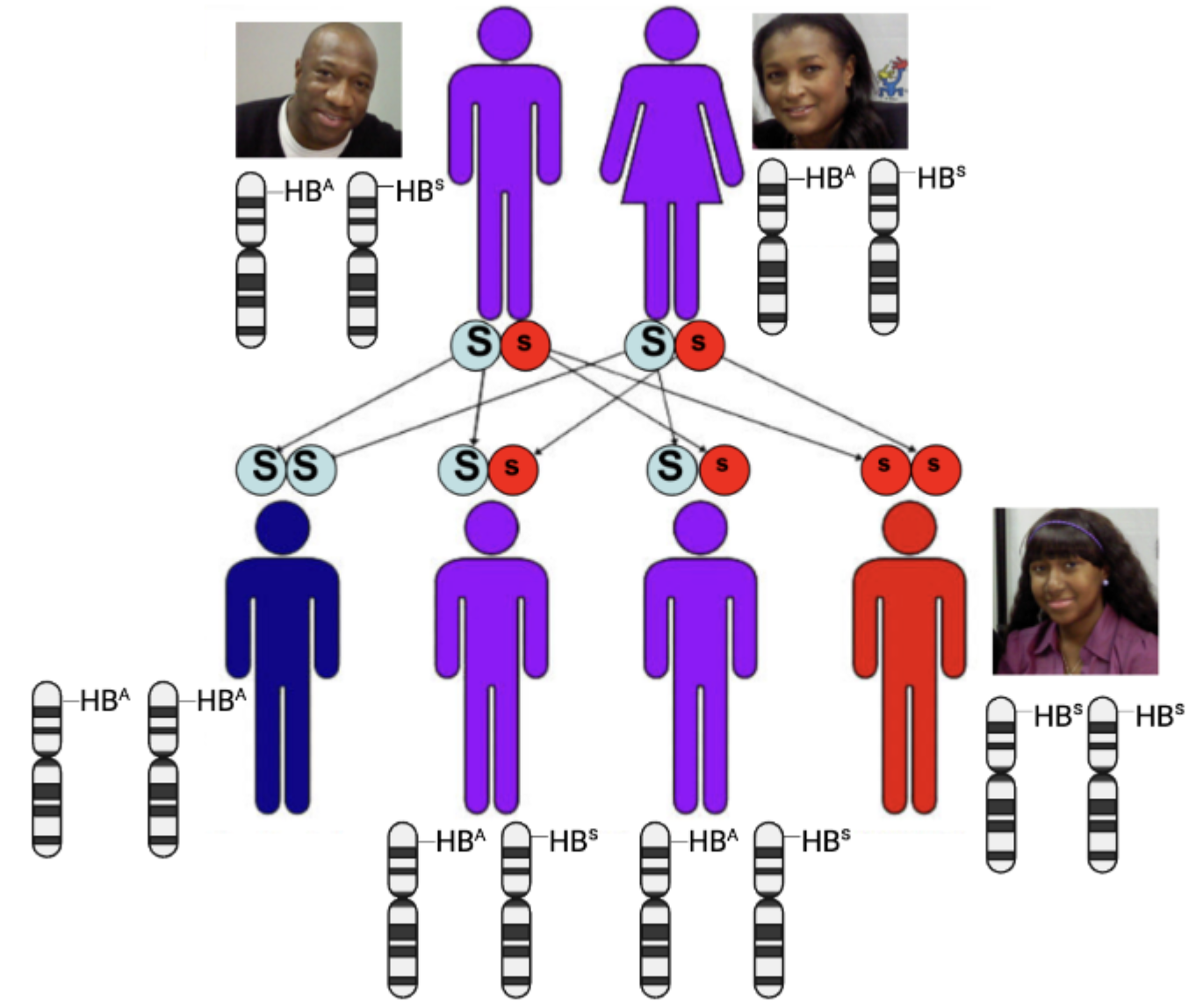 Hunter's father and his HB superscript A and superscript S-containing chromosomes are on the upper left. Hunter's mother with the same chromosomes is on the upper right. In the bottom row, all four possible combinations of chromosomes are listed: SS (two HB superscript A-containing chromosomes), two instances of Ss (one HB superscript A and one HB superscript S-containing chromosomes), and ss (two HB superscript S-containing chromosomes).