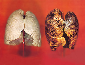 05_tobacco_large_EU_lung_02_en_medium