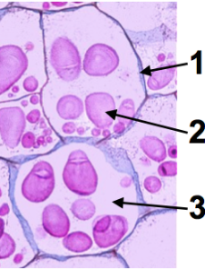 Dyed potato cells. Irregular pale pink cells with clear boundaries (1), multiple dark pink blobs inside each cell (2), and space surrounding the blobs (3).