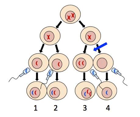 Nondisjunction. Haploid cells 1 and 2 contain one maternal chromosome and one paternal chromosome. Haploid cell 3 contains two maternal chromosomes and 1 paternal chromosome. Haploid cell 4 contains one paternal chromosome. A blue arrow points to meiosis 2 in the pathway that leads to cells 3 and 4.