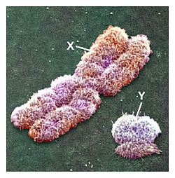 13_xy-chromosome