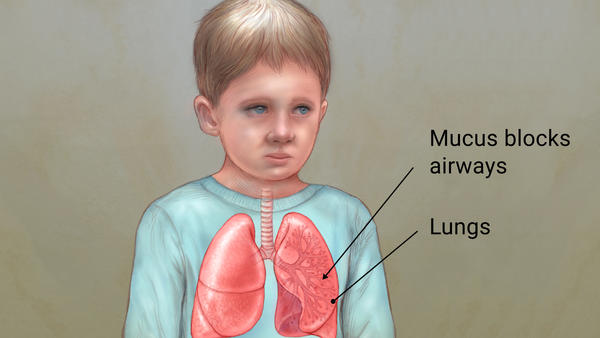 Child with lungs labeled, 