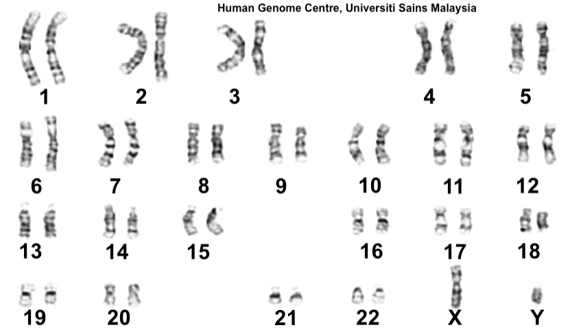 Numbered karyotype with 22 pairs of chromosomes, one X, and one Y.