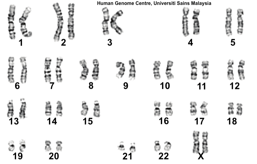 Numbered karyotype with 22 pairs of chromosomes and two X chromosomes.