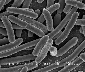 SEM photograph of pill-shaped bacteria. Labeled: EF6691 5.0 kV X15.0K 2.00 micrometers