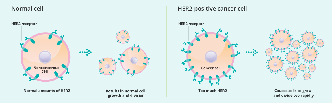 Left: Normal cell. Normal amounts of HER2 receptors in the cell results in normal cell growth and division. Right: HER2-positive cancer cell. Too much HER2 causes cells to grow and divide too rapidly.