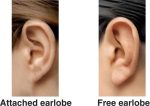 Pictures of an attached earlobe and a free earlobe.