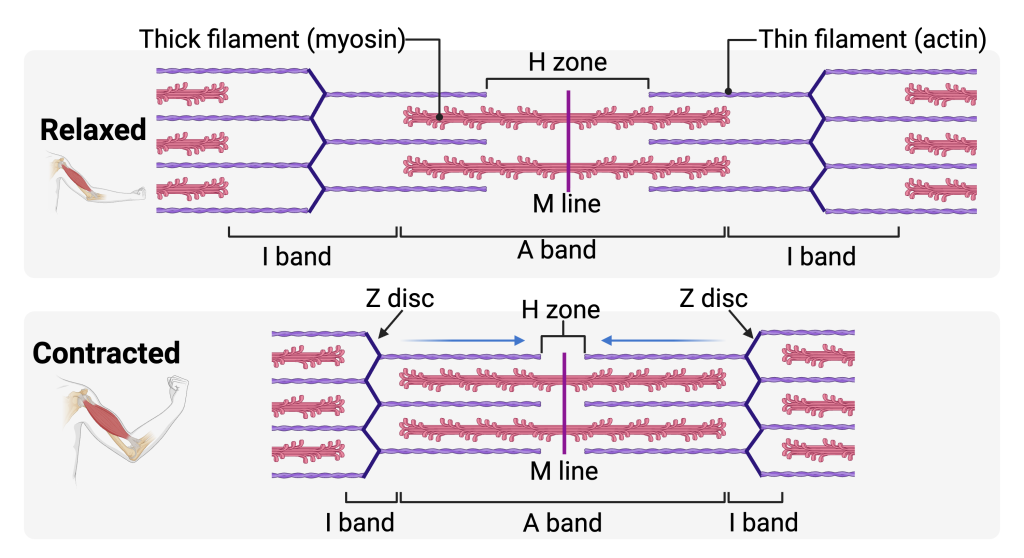 Diagram comparing a relaxed and a contracted sarcomere. In the relaxed state (top), Z discs are farther apart, I bands are wide, and a visible H zone lies at the center of the A band where only thick (myosin) filaments are present. In the contracted state (bottom), thin (actin) filaments slide inward toward the M line, Z discs move closer together, I bands shorten, and the H zone narrows or disappears, while the A band remains the same length.
