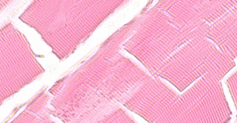 Light micrograph of skeletal muscle tissue viewed at high magnification. Parallel muscle fibers show a repeating pattern of light and dark bands (striations) running across each fiber, reflecting the organized arrangement of actin and myosin within myofibrils. The striations are visible only at higher magnification, where individual A bands and I bands can be distinguished.